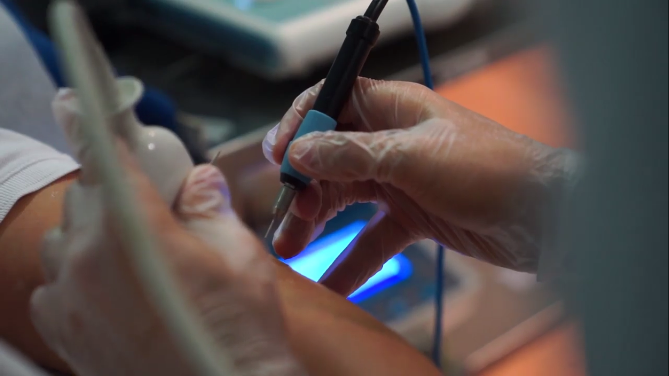 Electrolisis Percutánea Músculo-esquelética (EPM)